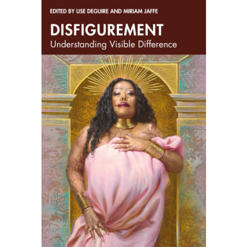 Disfigurement , Taylor & francis ltd (häftad, english)