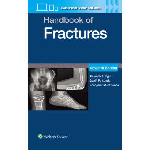 Wolters Kluwer Health Handbook of Fractures: Print + eBook with Multimedia (häftad, eng)