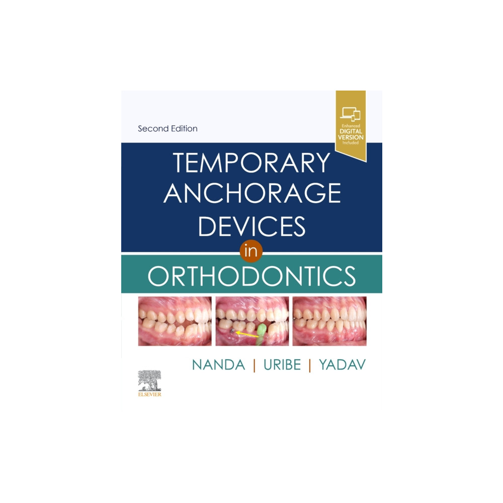 Produktbild för Temporary Anchorage Devices in Orthodontics (inbunden, eng)