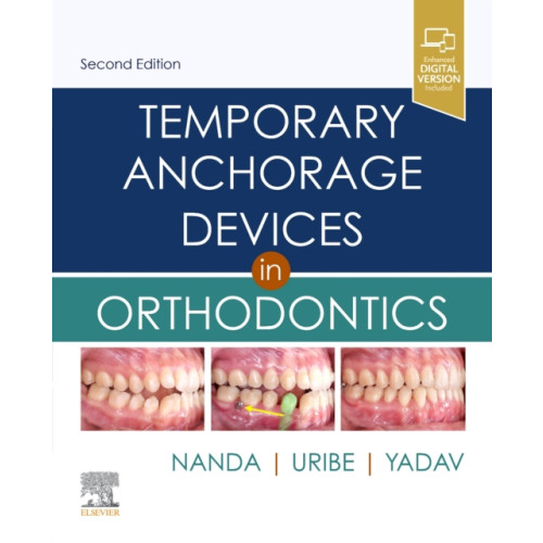 Elsevier - Health Sciences Division Temporary Anchorage Devices in Orthodontics (inbunden, eng)