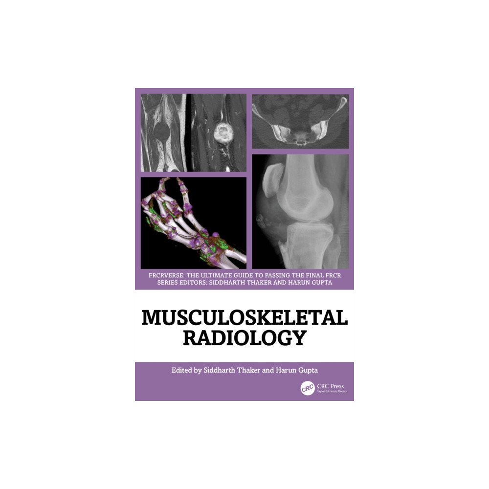 Produktbild för Musculoskeletal Radiology (häftad, eng)