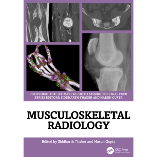 Taylor & francis ltd Musculoskeletal Radiology (häftad, eng)