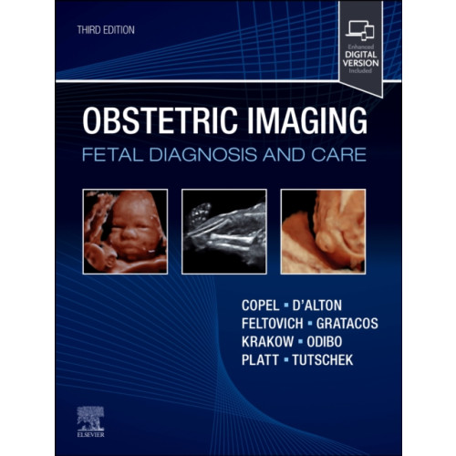 Elsevier - Health Sciences Division Obstetric Imaging: Fetal Diagnosis and Care (inbunden, eng)