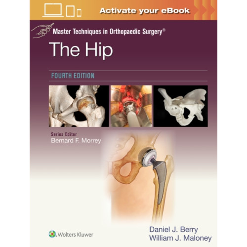 Wolters Kluwer Health Master Techniques in Orthopaedic Surgery: The Hip: Print + eBook with Multimedia (inbunden, eng)