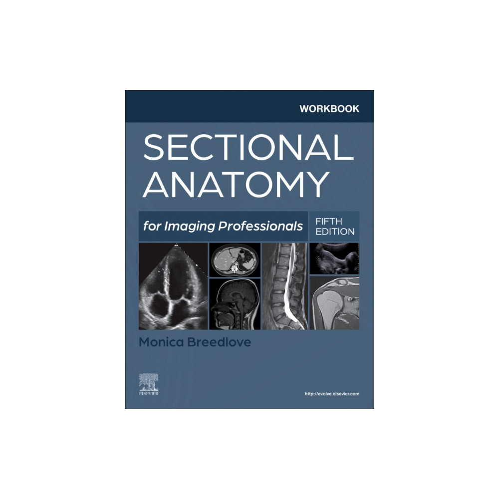 Produktbild för Workbook for Sectional Anatomy for Imaging Professionals (häftad, eng)