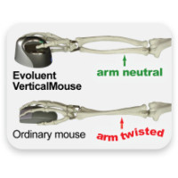 Produktbild för Evoluent VerticalMouse 4 Small - vertikal mus - USB