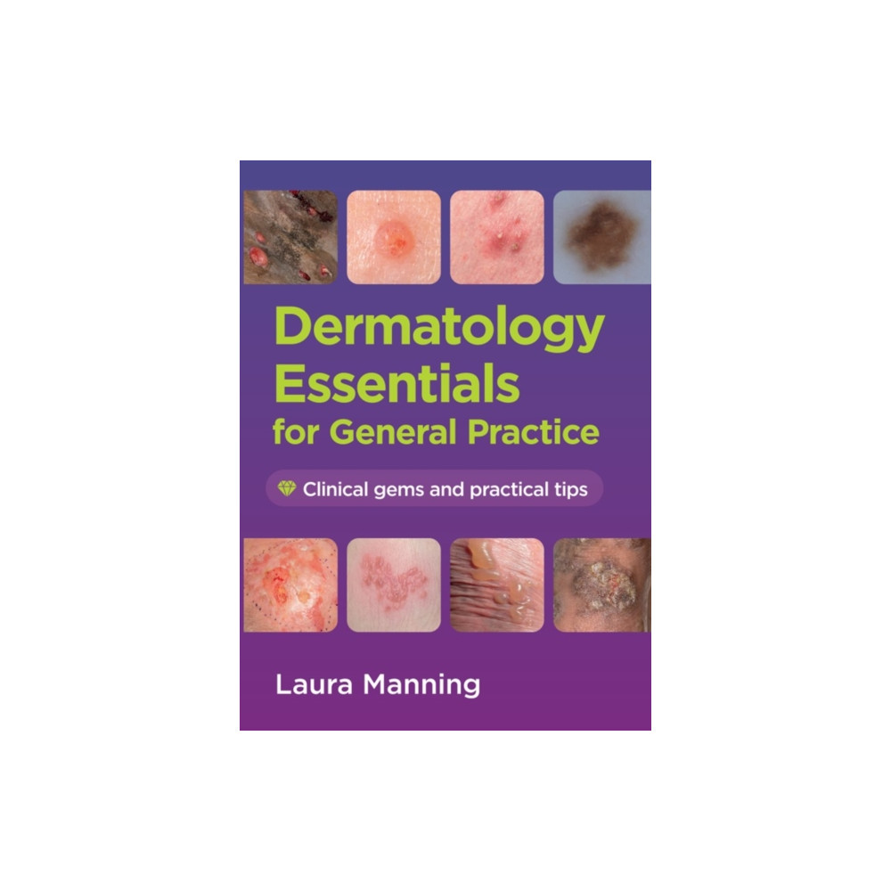 Produktbild för Dermatology Essentials for General Practice (häftad, eng)