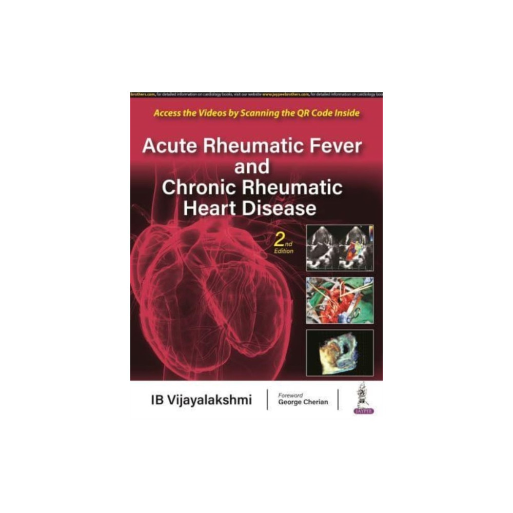 Produktbild för Acute Rheumatic Fever and Chronic Rheumatic Heart Disease (inbunden, eng)
