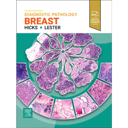 Elsevier Health Sciences Diagnostic Pathology: Breast (inbunden, eng)