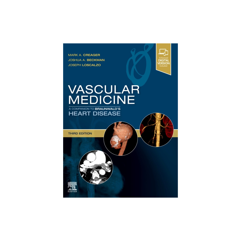 Produktbild för Vascular Medicine: A Companion to Braunwald's Heart Disease (inbunden, eng)