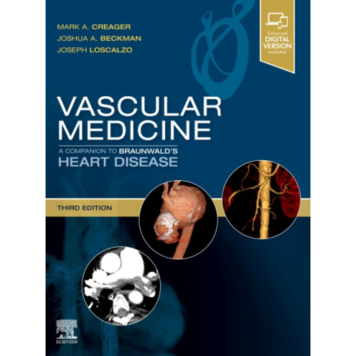 Elsevier - Health Sciences Division Vascular Medicine: A Companion to Braunwald's Heart Disease (inbunden, eng)