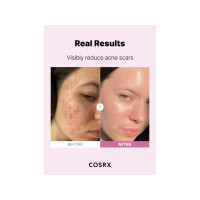 Produktbild för Triton COSRX serum med 15% niacinamid