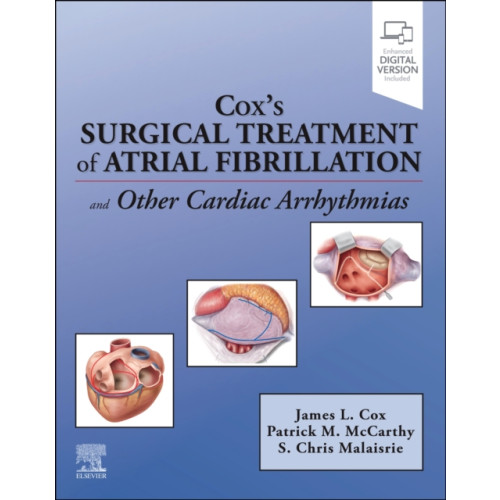 Elsevier Health Sciences Cox's Surgical Treatment of Atrial Fibrillation (häftad, eng)