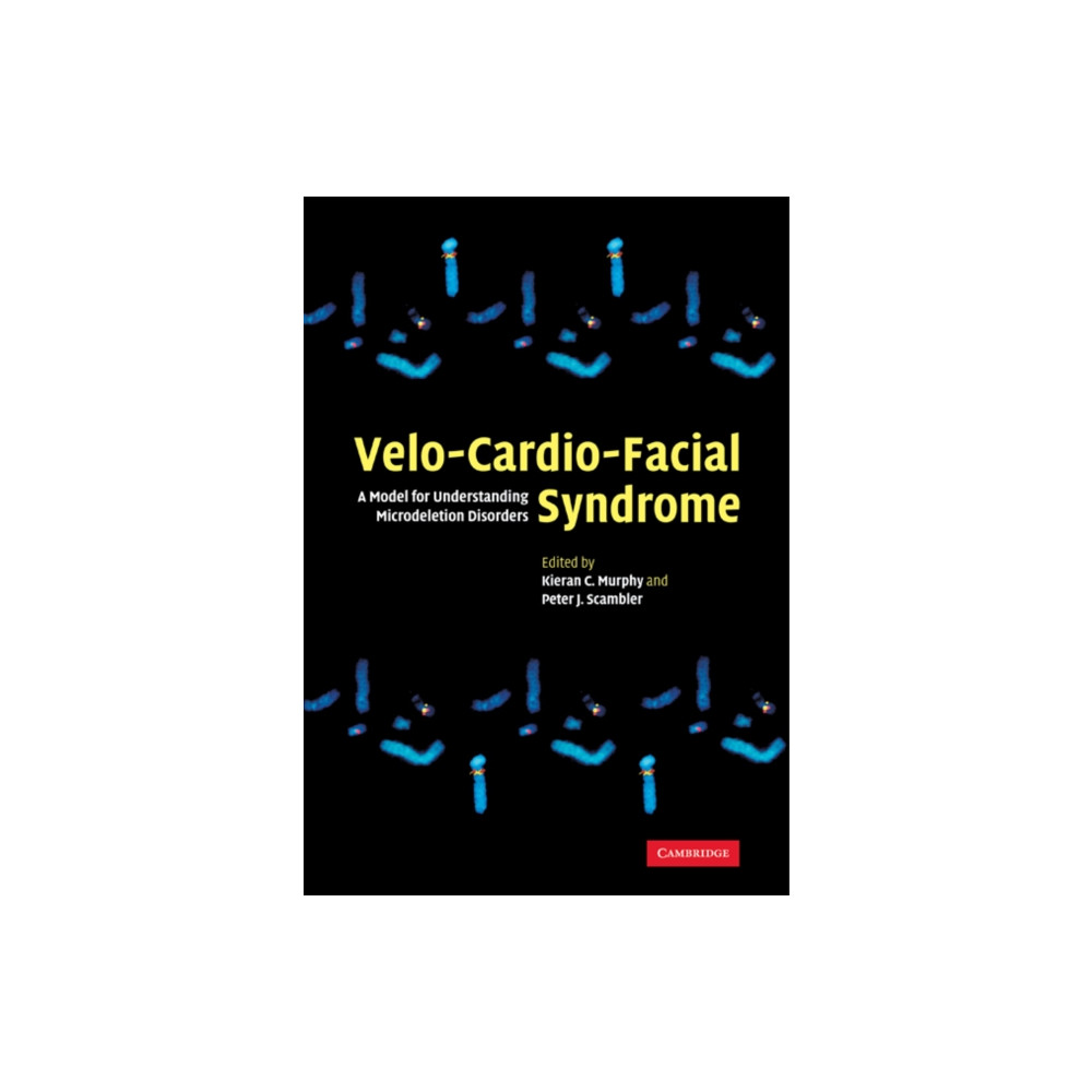 Produktbild för Velo-Cardio-Facial Syndrome (häftad, eng)