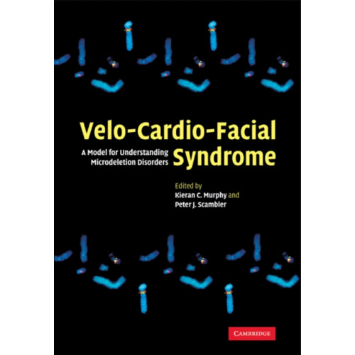 Cambridge University Press Velo-Cardio-Facial Syndrome (häftad, eng)