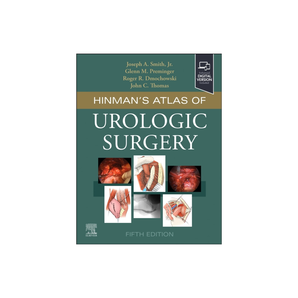 Produktbild för Hinman's Atlas of Urologic Surgery (inbunden, eng)