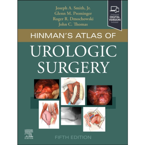 Elsevier - Health Sciences Division Hinman's Atlas of Urologic Surgery (inbunden, eng)