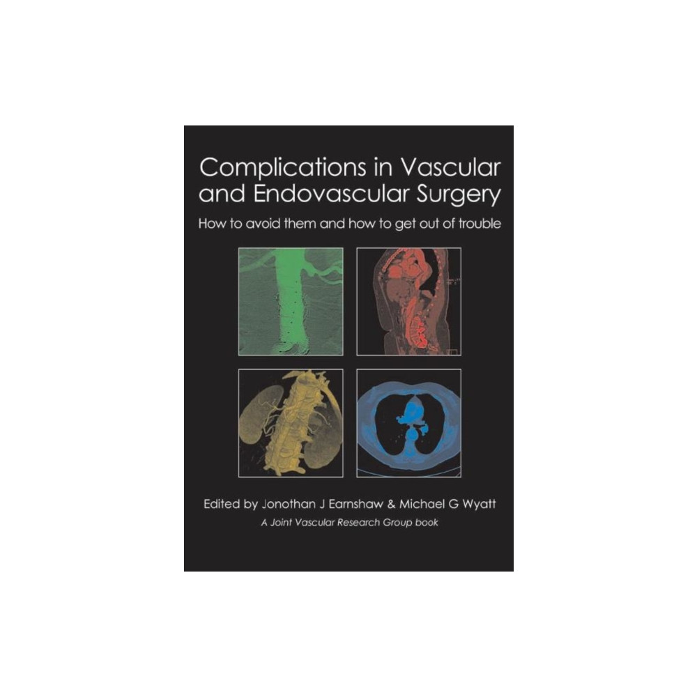 Produktbild för Complications in Vascular and Endovascular Surgery (inbunden, eng)