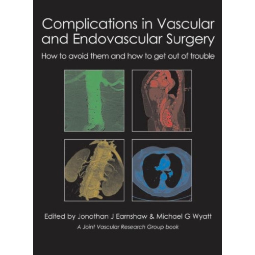 TFM Publishing Ltd Complications in Vascular and Endovascular Surgery (inbunden, eng)