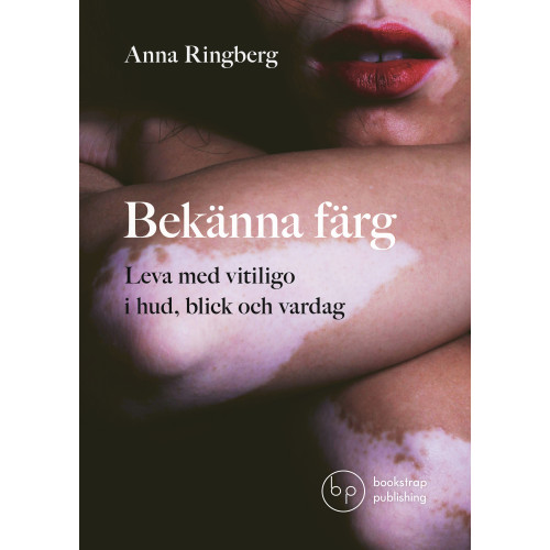 Anna Ringberg Bekänna färg : leva med vitiligo i hud, blick och vardag (bok, danskt band)